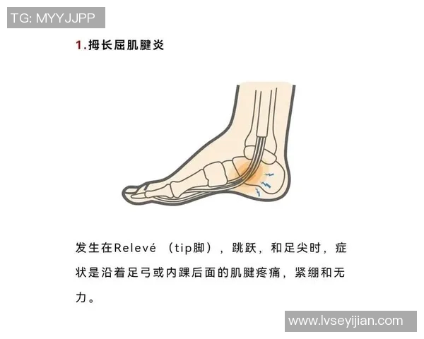深度解析伤病名单现状及未来发展趋势预测